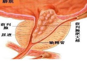 郑州前列腺检查费用是多少